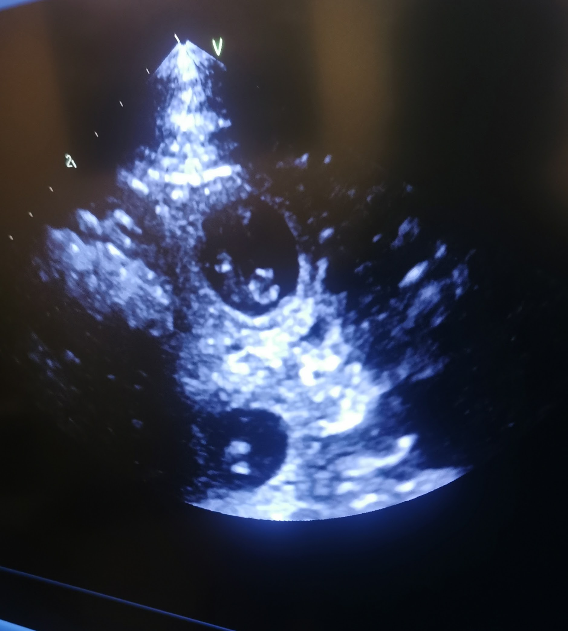 Ultrschallbild Skadi 7.11.21